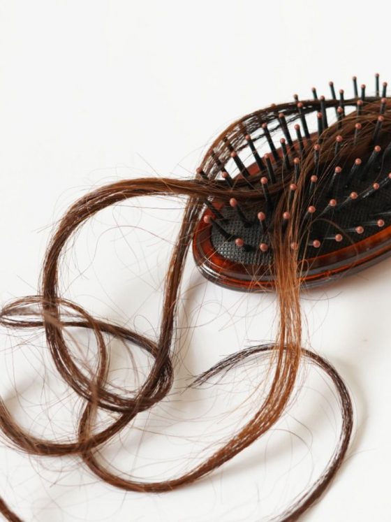 chute de cheveux kodd magazine medias beaute beauty coiffure hairstyle jollymama